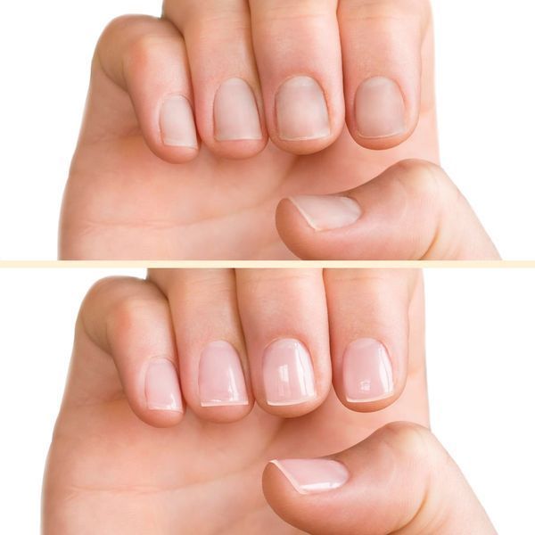 PNB Pink Nail Treatment, 15 ml PNB-6218 фото